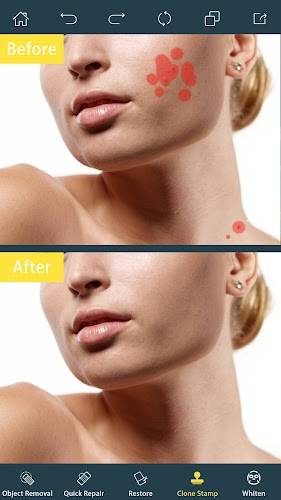 Photo Retouch- Object Removal Ảnh chụp màn hình 1