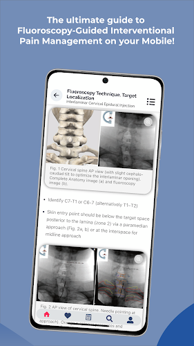 Interventional Pain App Capture d'écran 3