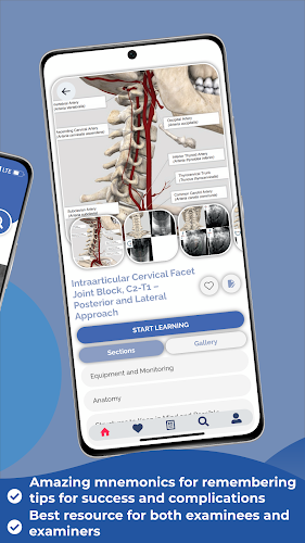 Interventional Pain App Tangkapan skrin 1