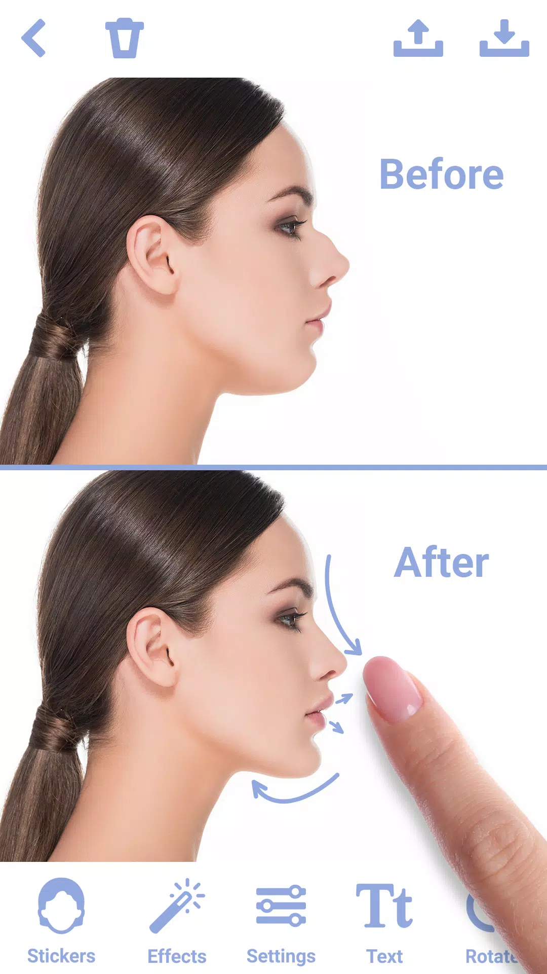 Rhinoplasty Ekran Görüntüsü 0