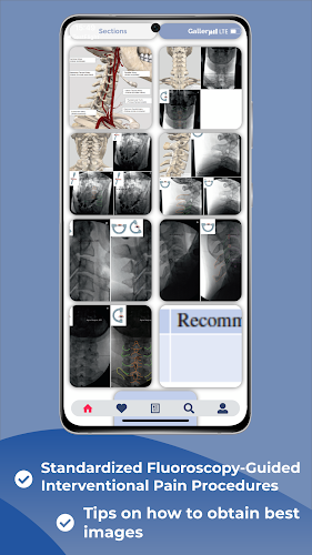 Interventional Pain App Screenshot 2